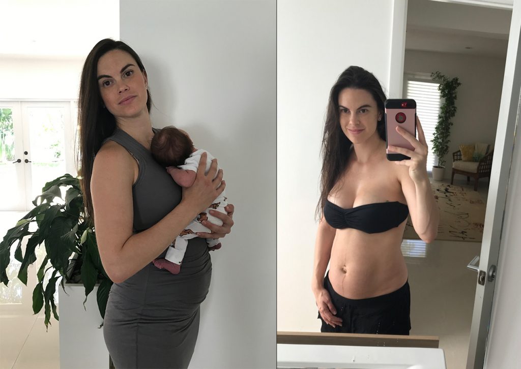 It's Time to Get Honest About Postpartum Bodies